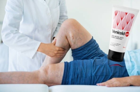Venicold Gel Opinie: Rozwiązanie dla Twoich Problemów Stawowych Venicold Gel Opinie: Rozwiązanie dla Twoich Problemów Stawowych